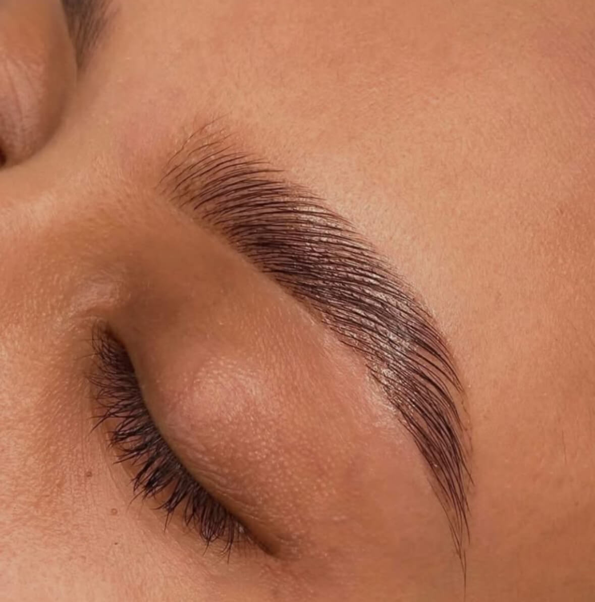 image illustrant la formation du browlift